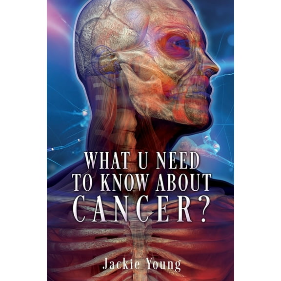 What U need to know about Cancer?, (Paperback)