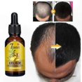 thumbnail image 5 of Ginger Infused Hair Growth Serum, Strengthening Repair Oil for Enhanced Vitality and Shine, Natural Solution for Thicker and Healthier Hair, 5 of 5