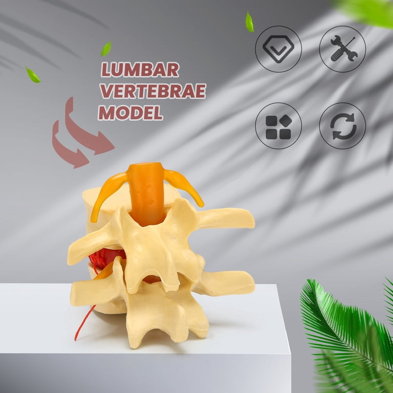 Spinal Herniation Demonstration Lumbar Disc Herniation Model - 1.5x ...