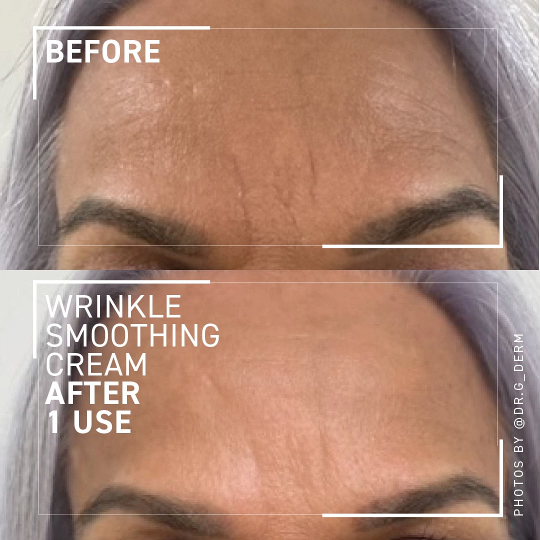 Dr. Brandt Skincare Needles No More® Wrinkle Smoothing Cream