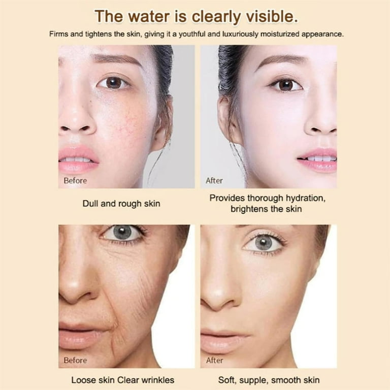 HHBEAUTY Ecdoin Anti-Aging Essence, Nuosili Face Spray, Tighten