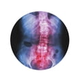thumbnail image 2 of SIDONKU 60 inch Round Beach Towel Blanket Spondylosis and Scoliosis Film X Ray Lumbar Sacrum Spine Travel Circle Circular Towels Mat Tapestry Beach Throw, 2 of 2