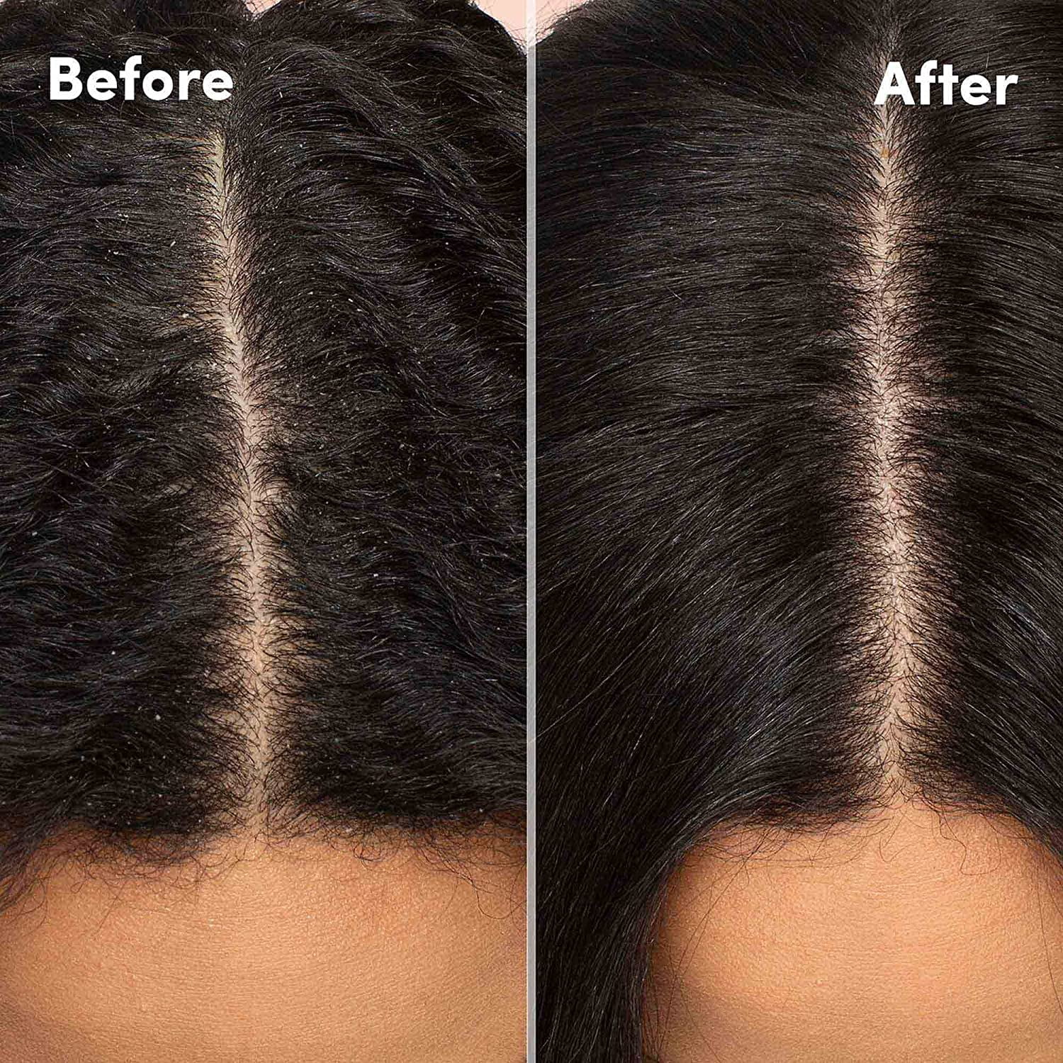 Mizani Scalp Care Reviving & Refreshing AntiDandruff Shampoo - 33.8 oz