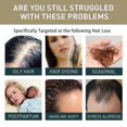 thumbnail image 2 of Anti-Hair Shampoo Deep Cleansing Head Massage Skin Anti-Hair Fixing Moisturizing Hair Dens, 2 of 4