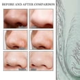 thumbnail image 4 of Jaysuing Blackhead Removal Essence Moisturizes And Tightens The Skin, Shrin |, 4 of 5