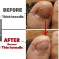 thumbnail image 5 of Toe Nail Files for Thick Nails,Stainless Steel 4 Sides 7 inch Length,Nail Files, 5 of 5