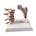 thumbnail image 3 of Modelo de Anatomía de Osteoporosis de Fémur Humano para Suministros Escolares de Enseñanza en El Hogar, 3 of 9