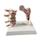 thumbnail image 3 of Modelo de anatomía de osteoporosis de fémur humano Aprenda accesorios de esqueletos Herramienta educativa para suministros escolares enseñando hogar, 3 of 8