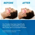 Neomen Anti Snoring Mouthpiece, Sleep Aid Night Guard, Teeth Grind