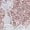 Light Pink, variant on YLYL Fashion Sneakers for Women Floral Embroidery Breathable Mesh Lace Slip on Platform Wedge Casual Walking Shoes