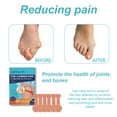 thumbnail image 3 of 2pcs Toe Corrector Composite Patch, Relieve Big Toe Valgus Joint Pain And Swelling Foot Care Correction Patch, 3 of 5