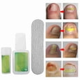 thumbnail image 3 of Kit De Eliminación De Uñas Encarnadas, Kit Profesional De Corrección De Uñas Encarnadas Con Barra De Esmalte Y Pegamento Para Uñas, Parches Elásticos Para Un Crecimiento, 3 of 7