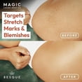 thumbnail image 3 of Besque Magic Body Oil, 3.4 FL OZ, After Shower Body Oil For Women, Hydrating Skin Care For Full Body That Plumps, Tightens, and Firms Skin With Natural Ingredients, Luxury Spa Gifts - Pack of 2, 3 of 6
