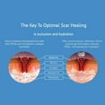 thumbnail image 4 of Clearance! Dermatix Silicone Gel Clinically Scar for All Skin Types Options Sky Blue, 4 of 8
