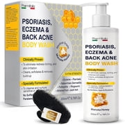 Pharmiitalia Psoriasis, Eczema & Back Acne Body Wash with Manuka Honey, Medical Grade Extra Strength Formula, No Sulfates Dyes or Parabens, 6.76 Fl Oz (200ml)