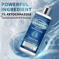 thumbnail image 4 of Anti Fungal Shampoo for Folliculitis, Seborrheic Dermatitis, Psoriasis, Anti-Dandruff Shampoo, Relieves Itchy and Dry Scalp, Cleansing Oil Control Sha, 4 of 4