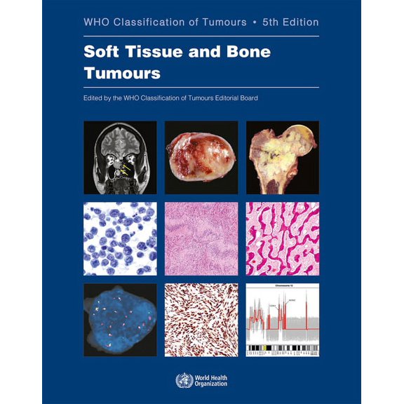 WHO Classification of Tumours Soft Tissue and Bone Tumours: Who Classification of Tumours, (Paperback)
