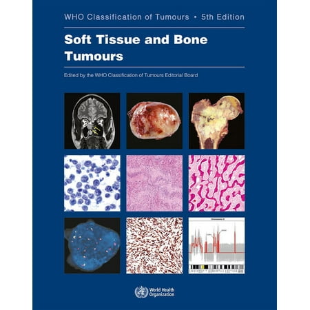 UPC: 9789283245025 | WHO Classification of Tumours: Soft Tissue and Bone Tumours: Who Classification of Tumours (Paperback)