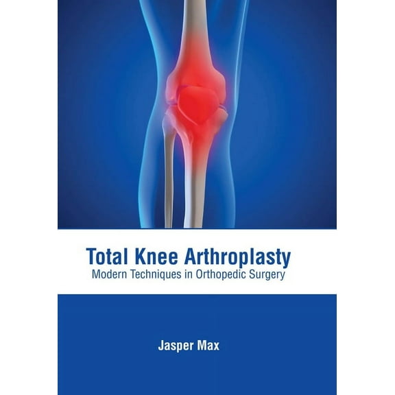 Total Knee Arthroplasty: Modern Techniques in Orthopedic Surgery, (Hardcover)