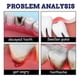 thumbnail image 5 of 3pcs Toothache Gum Toothache Toothache Licorice Tooth Decay Worm Tooth Caries, 5 of 5