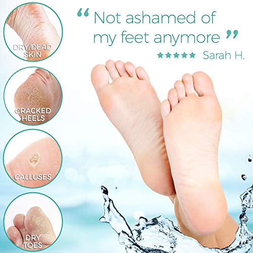 Dermora Foot Peel Mask For Cracked Heels Dead Skin Calluses Exfoliating Peeling Treatment 2 Pack Walmart Com