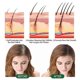thumbnail image 3 of Rosemary Dense Hair Shampoo Soap Anti-Dandruff Hair urishing Hair Care Moisturizing And urishing Scalp Improve Frizzy Hair, 3 of 4