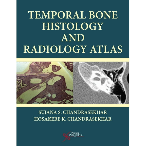Temporal Bone Histology and Radiology Atlas (Paperback)