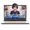Rose Gold, variant on 15.6" IPS FHD Gaming Laptop AMD Ryzen 7 Pro 6850U 32GB LPDDR5 RAM 1TB SSD (Beat i7-1360P, 8 Cores Up to 4.7GHz) with AMD Radeon 680M GPU 100W Type-C Backlit Keyboard Fingerprint