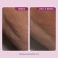 thumbnail image 3 of Dekliderm Neck Firming Cream for Neck, Chest & Arms – Tightening and Smoothing Cream for Crepey Skin, Wrinkles & Sagging Appearance, 3 of 9