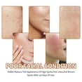thumbnail image 5 of QunYou Provides A Fresh Cleansing Experience for The Effectively Removing Dirt and Oil 100g, 5 of 9