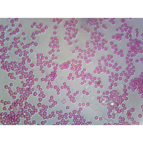 Meningococcus (Neisseria Meningitidis); Smear; Gram-Negative by Go Science Crazy