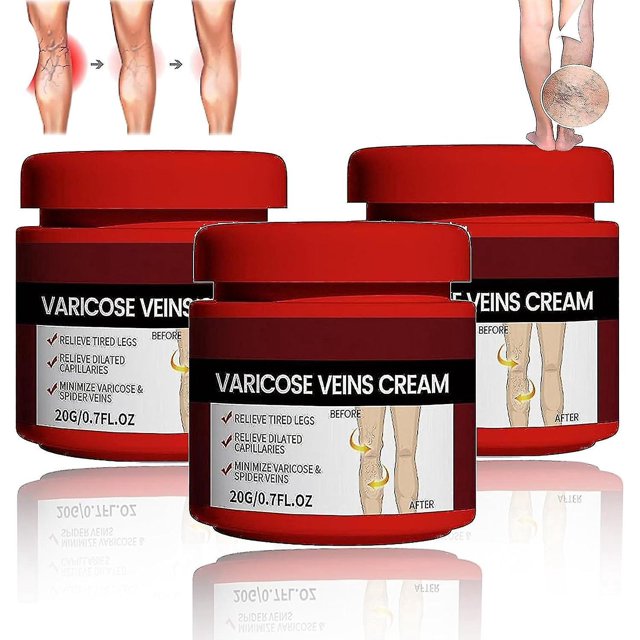 Tratamiento para venas varicosas en piernas, crema calmante para venas varicosas y piernas, fortalece la salud capilar y reduce las arañas vasculares, 3 unidades