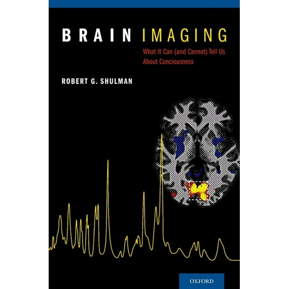 Brain Imaging: What It Can (and Cannot) Tell Us about Consciousness, (Hardcover)
