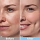 thumbnail image 4 of Almohadillas faciales exfoliantes de ácido salicílico Kestper, 70 unidades, 4 of 7