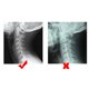 thumbnail image 2 of Fijación de tracción Soporte Tracción del cuello ajustable cervical Corrección de cuello de diente Camilla de alivio del dolor dispositivo de tracción del cuello, mentoniera para tracción Ecomeon no, 2 of 6