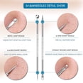 thumbnail image 4 of Wosthever 7 unids/set Kit de herramientas de eliminación de espinillas herramientas prácticas de espinillas herramientas de cuidado Facial Almacenamiento y organización del hogar, 4 of 6