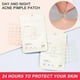 thumbnail image 2 of Acne Pimple Patch Stickers Acne Treatment Pimple Remover Tool Blemish Spot Facial, 2 of 5