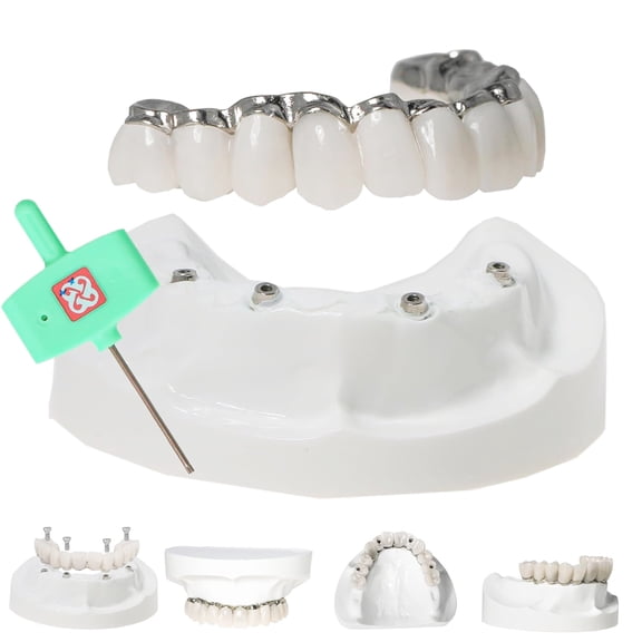 M6023 Dental All-on-4 Overdenture Model Upper Jaw Implants Restoration 4 Screws