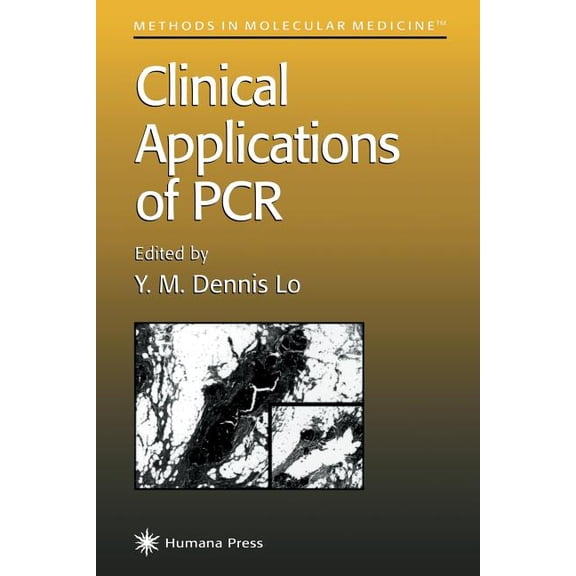 Methods in Molecular Medicine Clinical Applications of PCR, Book 16, (Paperback)