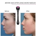 thumbnail image 4 of Silky Smooth Skin, Microneedle Derma Roller Set With Versatile Tool And Simple Use, Reduces Dark Circles And Minimizes Enlarged Pores, 3PCS, 4 of 6