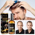 thumbnail image 2 of Ginger Hair Care Essential Oil Mild ingredients moisturize hair tail, smooth hair, ginger essence hair care oil, 2 of 5