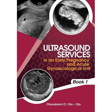 UPC: 9781908015075 | Ultrasound Services in an Early Pregnancy and Acut: Ultrasound Services in An Early Pregnancy and Acute Gynaecological Unit (Series #BOOK1) (Paperback)