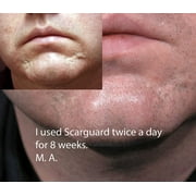 Scarguard MD 0.5 fl oz