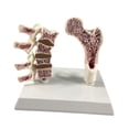 thumbnail image 2 of Modelo de Anatomía de Osteoporosis de Fémur Humano para Suministros Escolares de Enseñanza en El Hogar, 2 of 9