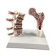 thumbnail image 2 of Modelo de anatomía de osteoporosis de fémur humano Aprenda accesorios de esqueletos Herramienta educativa para suministros escolares enseñando hogar, 2 of 8