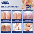thumbnail image 3 of Kit de reparación de uñas VigorWell Extra Strength 30 mL con 25% de ácido, 3 of 6