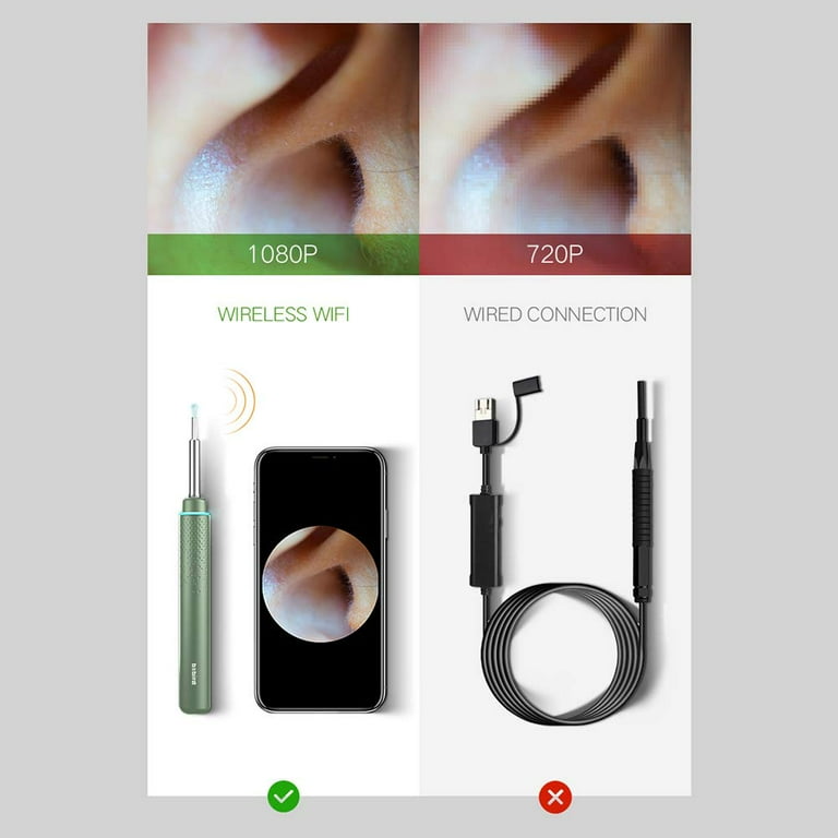 pro ear endoscope