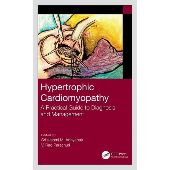 Hypertrophic Cardiomyopathy: A Practical Guide to Diagnosis and Management, (Hardcover)