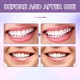 thumbnail image 2 of Tooth Shine Crystal Drill Dental Jewelry Adhesive Fixing Dental Rhinestone Glue 7m, 2 of 5
