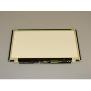 Acer Chromebook C710 New Replacement 11.6" LED LCD Screen WXGA HD Laptop Glossy Display fits C710-2834, C710-2487, C710-2055, C710-2411, C710-2457, C710-2481, C710-2487, C710-2688, C710-2815, C710-282